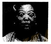 2017年安徽成人高考专升本《医学综合》考试真题2 2017年安徽成人高考专升本《医学综合》考试真题2