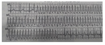 2017年安徽成人高考专升本《医学综合》考试真题3 2017年安徽成人高考专升本《医学综合》考试真题3